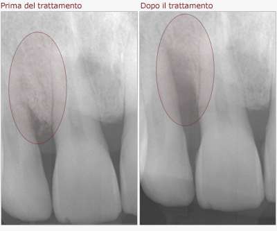 Che cosa è la parodontologia?