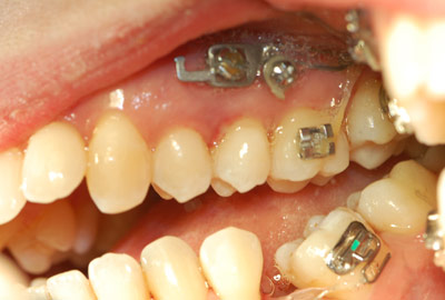 dott roberto rossi dentista rho dott roberto rossi dentista rho