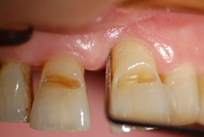 ortodonzia bambini