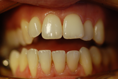 dott roberto rossi dentista rho dott roberto rossi dentista rho