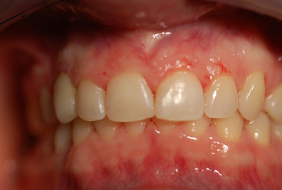 ortodonzia rho