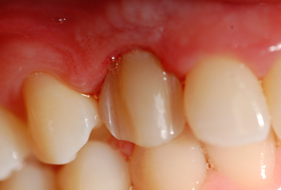 ortodonzia rho