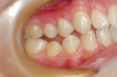 dott roberto rossi dentista rho dott roberto rossi dentista rho